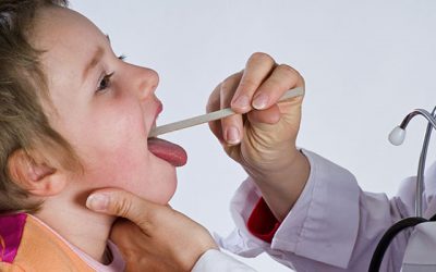 Does My Child Need a Tonsillectomy?