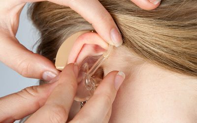 Restoring Hearing: How Do Cochlear Implants Work?